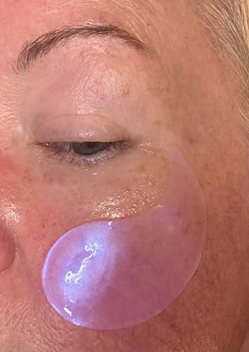 Close-up of under-eye skincare treatment
