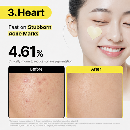 7-Day Dark Spot Fade Patches